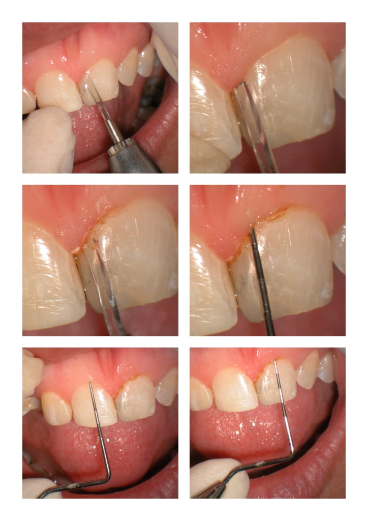 DB anterior case pg 2.jpg